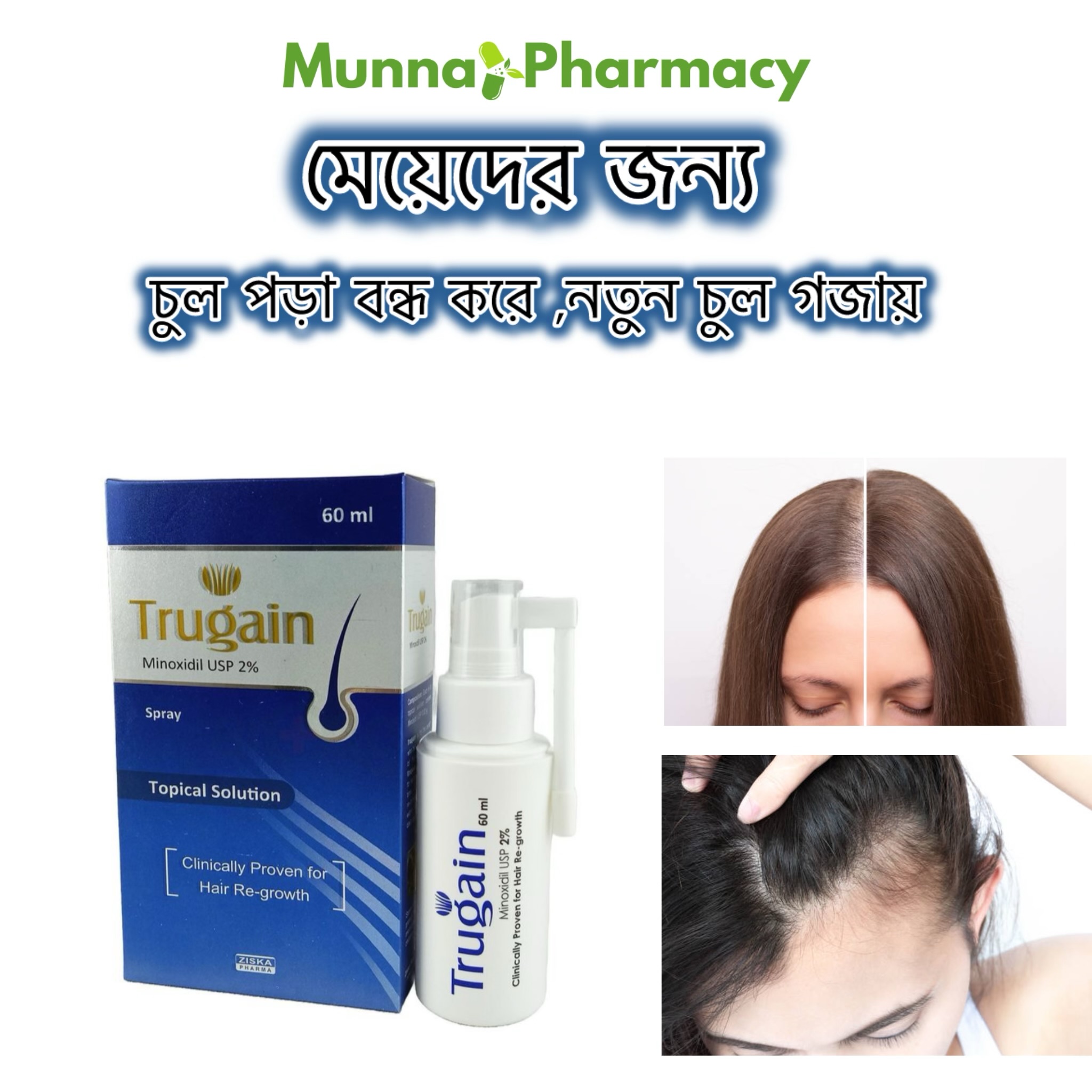 Trugain 2%(মহিলাদের জন্য)